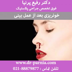 خونریزی بعد از عمل بینی