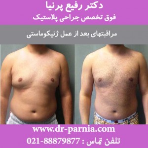 مراقبتهای بعد از عمل ژنیکوماستی