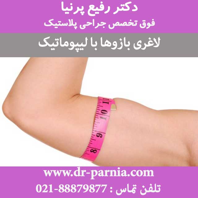 لاغری بازوها با لیپوماتیک