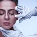 بلفاروپلاستی
