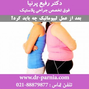 بعد از عمل لیپوماتیک چه باید کرد؟