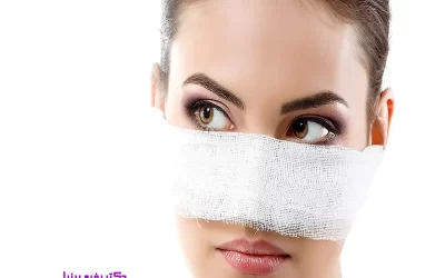 هرآنچه باید درباره جراحی زیبایی بینی بدانید