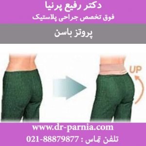 پروتز باسن 