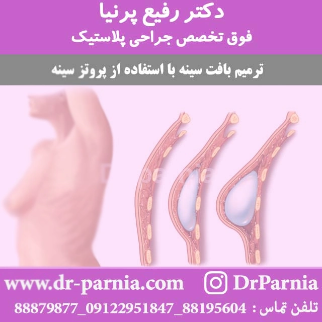 ترمیم بافت سینه
