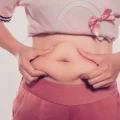 جراحی زیبایی شکم