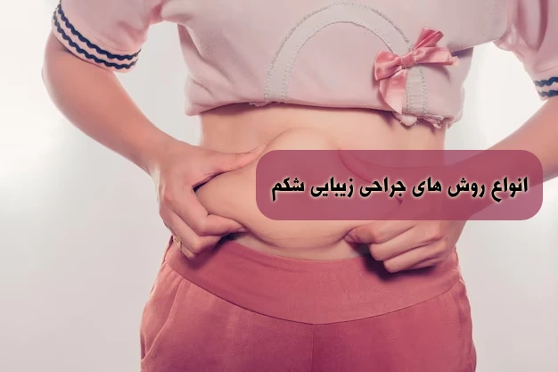 جراحی زیبایی شکم